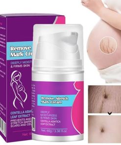 Guanjing Remove Stretch Mark Cream