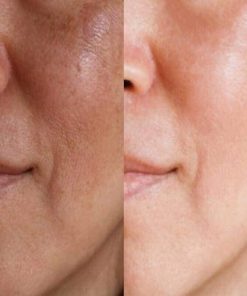 Mengfu collagen skin tightening cream