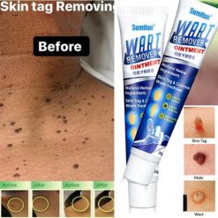 Wart Remover Ointment Cream