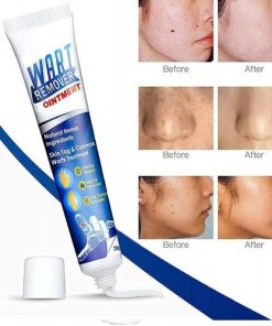 Wart Remover Ointment best product