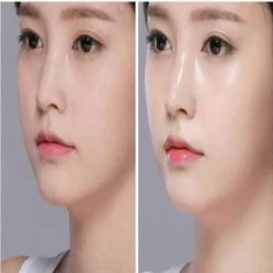 LCI bright & All whiteing cream