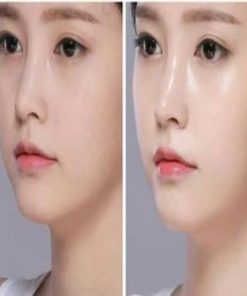 LCI bright & All whiteing cream