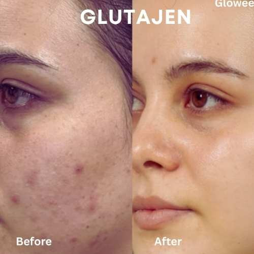 Glutajen Skin Brightening Night Cream